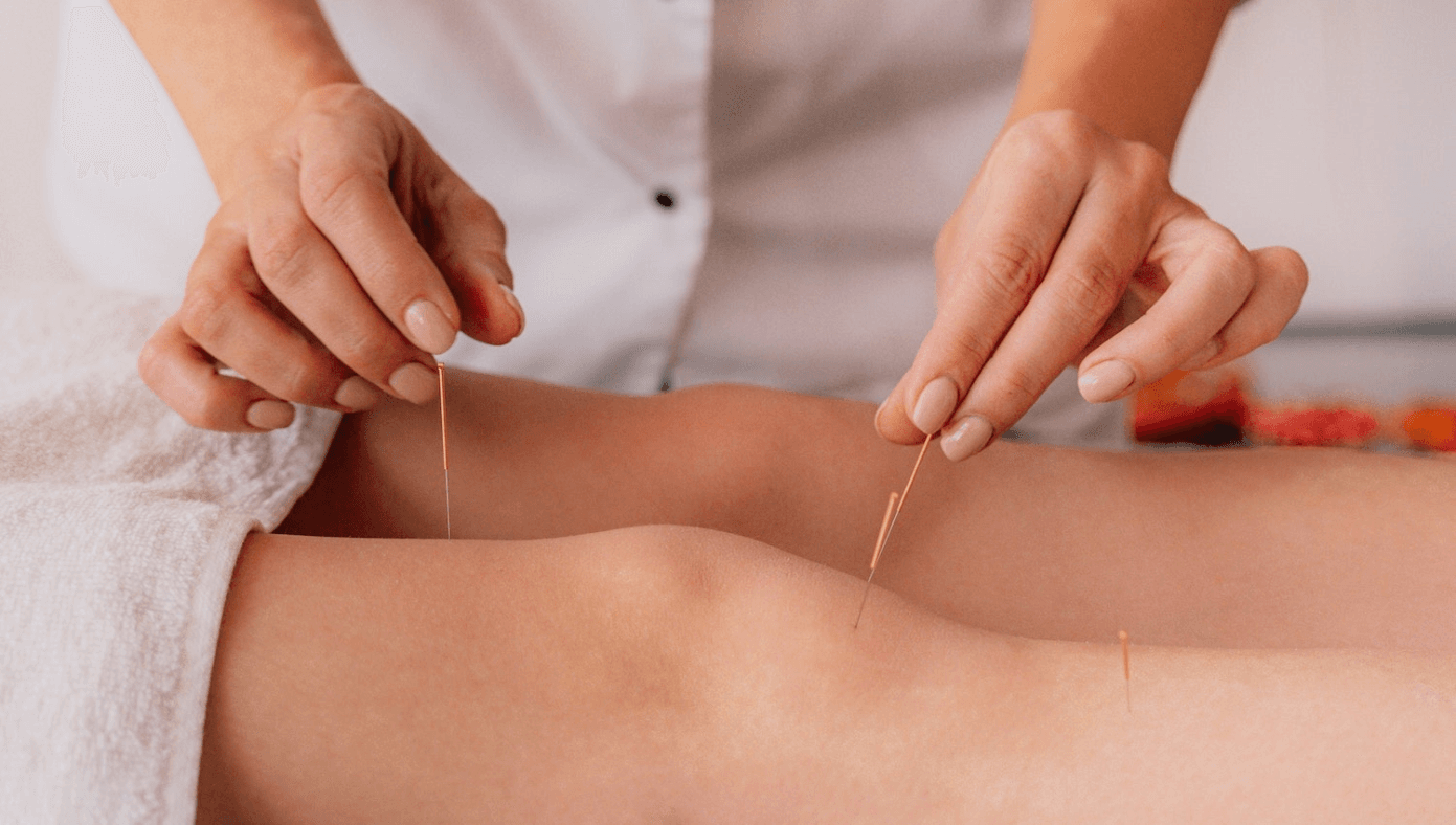 Image for Acupuncture, Tuina Massage and Cupping